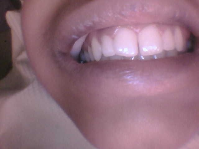 Patient smile after dental treatment at Town Centre Dental Clinic Scarborough